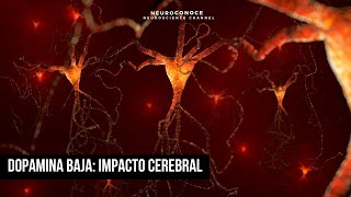 ¿Qué pasa cuando el cerebro tiene un déficit de dopamina [upl. by Allemaj]