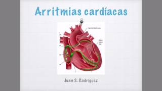 Arritmias cardíacas en el EKG [upl. by Marfe351]