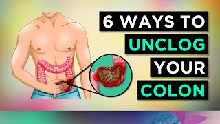 6 Ways To CLEAR Your CONSTIPATION [upl. by Clerk]