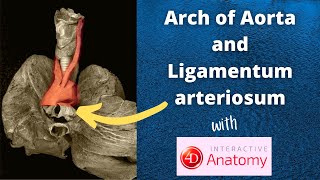 Arch of Aorta  Branches  Relations  Ligamentum arteriosum  Dr Doris [upl. by Vorfeld530]