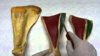 Comparative scapula by dr khaled shoghy [upl. by Enixam32]