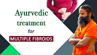 Ayurvedic Treatment for Multiple Fibroids  Swami Ramdev [upl. by Petronille]