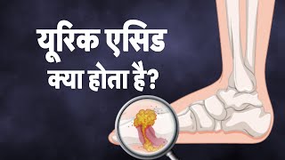 Health Care  क्या आपके जोड़ों के दर्द की वज़ह Uric Acid तो नहीं जानिए इस वीडियो में  TV9D [upl. by Abey]