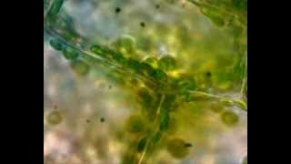 Práctica observación ciclosis Cellular cyclosis in Elodea canadensis [upl. by Leela]