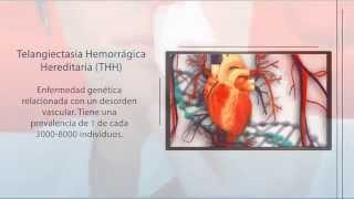 THH Telangiectasia Hemorrágica Hereditaria  Diagnóstico Genético  Secugen [upl. by Marin802]