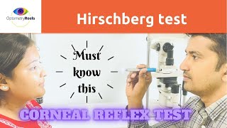 Hirschberg Test II Corneal light reflex test [upl. by Kiehl]