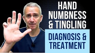 Hand Numbness amp Tingling Diagnosis amp Treatment [upl. by Llenna]