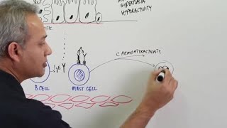 Asthma  Pathophysiology [upl. by Ocramed]