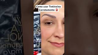 Como usar tretinoína corretamente tretinoincream tretinoin tretinoina pelemadura retinol [upl. by Assenav172]