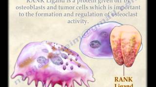 Osteoclasts  Everything You Need To Know  Dr Nabil Ebraheim [upl. by Orin]