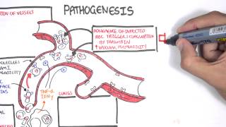 Malaria Pathophysiology [upl. by Bornie]