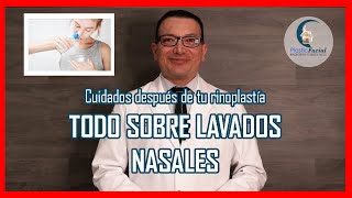 Esta es la manera correcta de realizar los lavados nasales despues de una Rinoplastia [upl. by Tychonn645]