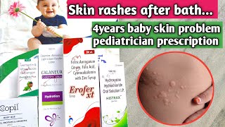 4 years baby skin rashes control with calamine lotion amp copil soap amp Atarax syrup [upl. by Roselani]