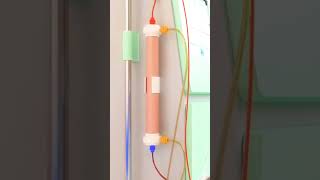 dialysis process animation dialysistechnician kidney bloodcleanser [upl. by Ayamat368]