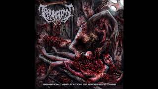 Traumatomy  Beneficial Amputation Of Excessive Limbs  2014   Full Ep [upl. by Duke]