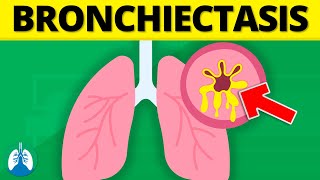 Bronchiectasis Medical Definition  Quick Explainer Video [upl. by Ashely]