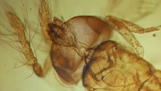 ПОД МИКРОСКОПОМ🐜 НАЕЗДНИК ТРИХОГРАММА БИОМЕТОД И ПАРАЗИТЫ ЯИЦTrichogramma Under Microscope UKRAINE [upl. by Bradleigh]