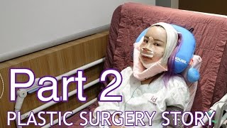 MY PLASTIC SURGERY STORY IN KOREA  Part 2 [upl. by Acenom374]