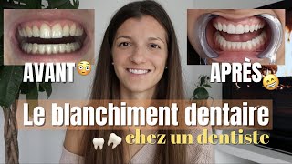 BLANCHIMENT DENTAIRE chez le dentiste prix durée sensibilité [upl. by Aeriela]