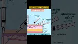 Type of Injection  Parenteral Route of Administration shayari pwmotivational motivation [upl. by Nylzaj971]