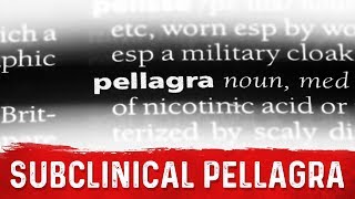 Subclinical Pellagra Vitamin B3 Deficiency – DrBerg [upl. by Grata646]