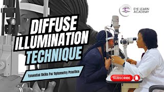 Diffuse Illumination Demystified Essential Skills for Optometry Practice  Eye Learn Academy [upl. by Ancilin]