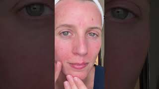 Qure AtHome Microneedling Levels Up Your Skincare [upl. by Rotce631]