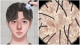 ASMR 보기만해도 시원한 대왕 두피각질 제거 애니메이션Big Flakes Dandruff Scratching Animation [upl. by Mercuri392]