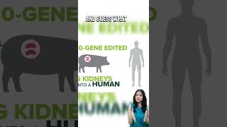 Medical Breakthrough First Ever Pig Kidney Transplant to Human youtubeshorts [upl. by Sutniuq]