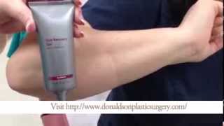 How To Apply Scar Gel or Cream [upl. by Imat]