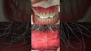 From Bite Block to TryIn dental teeth smile lsk121shorts dentures shortvideo shorts [upl. by Ahsircal3]