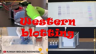 Western Blotting Theory amp Lab Procedure [upl. by Ennairam]