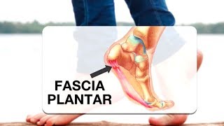 La lesión más temida por los corredores la fascitis plantar [upl. by Shum959]