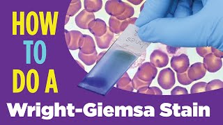 How to do a hematology stain WrightGiemsa stain Laboratory Tutorial Procedure [upl. by Anattar]