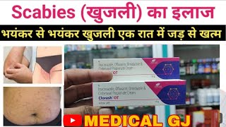 Clorash ot cream  dad khaj khujli ki cream  antifungal cream  smartway  क्लोराश ओटी क्रीम [upl. by Lasley]