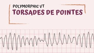 Torsades de Pointes [upl. by Eiramanad796]