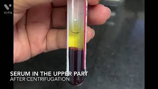 How is serum extracted from the blood sample [upl. by Dich574]