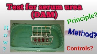 DAM Method for Urea estimation [upl. by Hough]