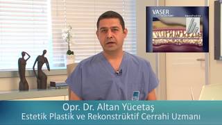 Vaser Liposuction Vaser Lipo Ameliyatı Nedir  Op Dr Altan Yücetaş [upl. by Cathie]