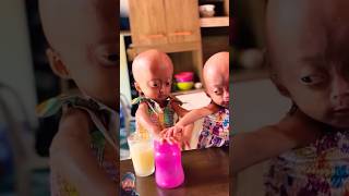 Please help 🙏 viral trending shorts twins baby [upl. by Coyle]