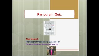 Partogram Quiz [upl. by Clarice610]