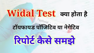 Widal test report reading in hindi  Widal test positive report  Widal Test in hindi [upl. by Bili196]