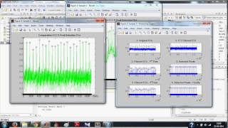 ECG Signal Processing in MATLAB  Detecting RPeaks Full [upl. by Millisent]