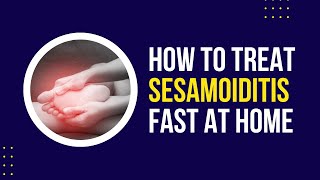 Sesamoiditis Treatment What Can I Do at Home [upl. by Ahsuoj913]