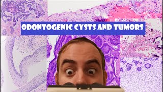 The ULTIMATE Odontogenic Cyst and Tumor Review Video [upl. by Scharff]