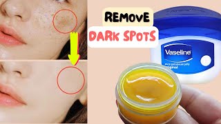 Apply Vaseline amp Turmeric on Face to Remove DARK SPOTS in 3 Days  Best Collagen Cream for Wrinkles [upl. by Nellir]