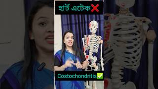 Chest painহাৰ্ট এটেক❌️Costochondritis ✅️ChestPainRelief heartattack Costochondritis [upl. by Innos223]