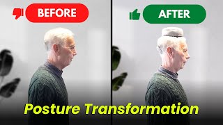 Fixing Posture Before and After Results Watch till the end [upl. by Ima]