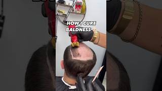 HOW I CURE BALDNESS 👨🏻‍🦲Pittsburgh Area📍Link In Bio to Book✅ pittsburghbarber beards [upl. by Harolda]