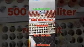 CALCIUM TEST PROCEDURE ll CALCIUM TEST IN HINDI [upl. by Grethel]